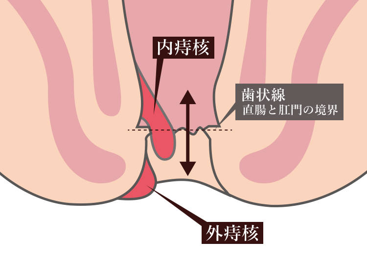 ibozi03