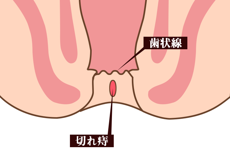 kirezi20