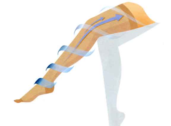 varicose-veins-treatment11